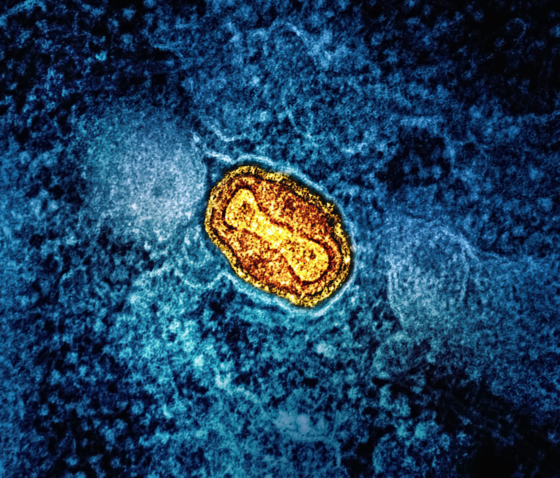 a yellow substance on a blue surface